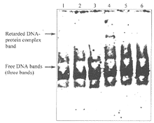 ����EMSA�������˦�1(��)��ԭ��������������DNA��ϵ���