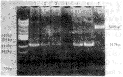 ԭ�����Ը���Ѫ��TTV DNA�ļ��������