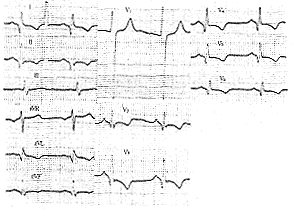 ������1��