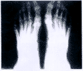 ��֢���߼̷��Լ�״���ٹ��ܿ�����ת���Ըƻ����㱳����1��