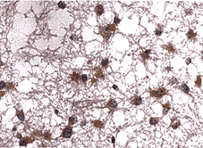 bcl-2��P53�����Խ������еı��Ｐ���������ֻ��Ĺ�ϵ