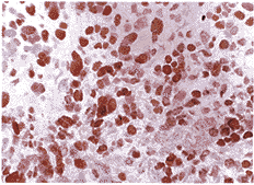 bcl-2��P53�����Խ������еı��Ｐ���������ֻ��Ĺ�ϵ