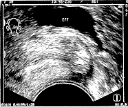 �������������������λ�����̽��