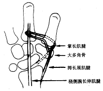 �Ƴ�������λ�ؽ��ʹ�����Ĵ���ƹؽ���λ