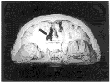 ­����άCT��­�����е�Ӧ�ü�ֵ