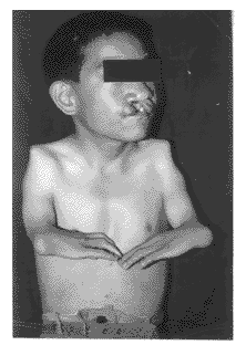 �����Դ��Ѱ�˫��֫���ػ���1��