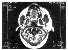 �����Ե�������ȱʧ1��