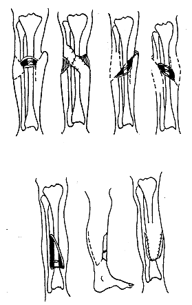 С�����ĤƤ���޸�����������ǹ��۹���¶56��