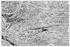 ת������������ԭ���Ըΰ��еı��Ｐ������̽��