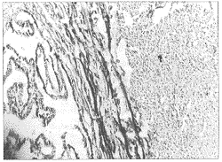 ���ѹ�ƽ������1��