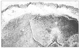 �������ٻ����1��