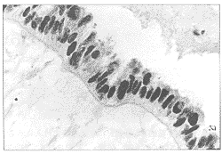 �ѳ�����p16���׵ı��Ｐ����