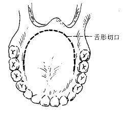 ΪۺƱʰ