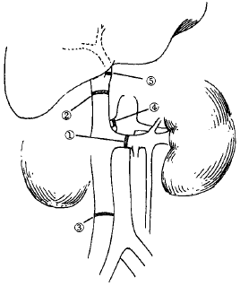 ������ǻ������˨����ϼ����ƣ���6�����沢���׸�ϰ��