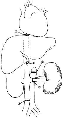 ������ǻ������˨����ϼ����ƣ���6�����沢���׸�ϰ��