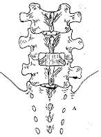��׵�ܻ��μ�ѹ��������׵����խ֢