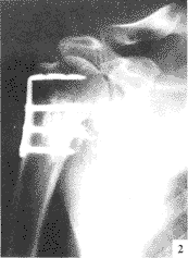 ����L�θְ��ڹ̶������Ź���ƾ�����