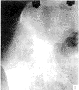 ǣ���պϸ�λʧ�ܵĹɹ�ת�Ӽ����