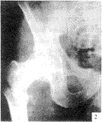 ǣ���պϸ�λʧ�ܵĹɹ�ת�Ӽ����