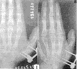 224-t1.gif (4771 bytes)