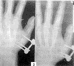 224-t2.gif (4614 bytes)