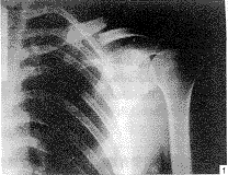 Ӧ�ô����ƿ������ڹ̶��������ǹ���