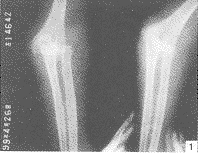 ��ؽ���λ�������Զ�˹���1��