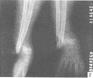 ��ؽ���λ�������Զ�˹���1��