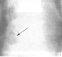 ��׵��Ե����֢14������