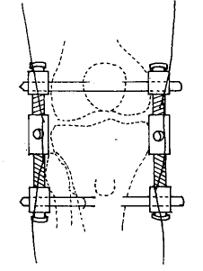 �������Ƽ������������