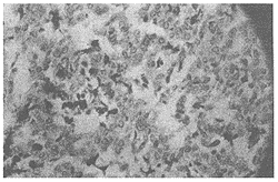 ��״�پֲ������������ű���״���װ����е�����