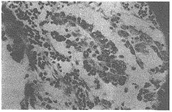 ��״�پֲ������������ű���״���װ����е�����