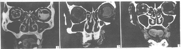 �᰼��Ӱ�����ѧ�о�