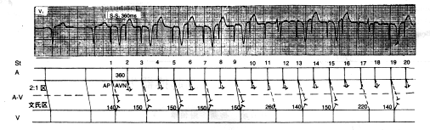 Kent�������������Ͷ���