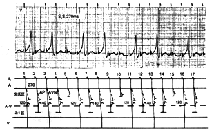 Kent�������������Ͷ���