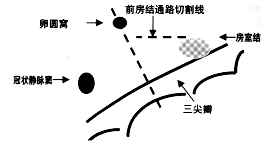 �и�ǰ����ͨ·�Լ��÷��ҽ���������Ե�Ӱ��<sup>*</sup>