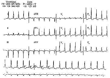 ���Ĳ������Ķ�������Ƶ����һ��