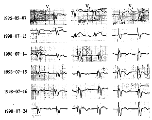 �����������߼����ļ��������ĵ�ͼ�仯һ��