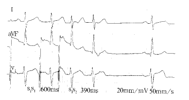 ˫�Ե��洫������˳���ͷ����۷����Ķ�����