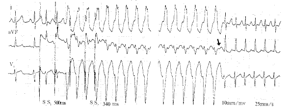 ˫�Ե��洫������˳���ͷ����۷����Ķ�����