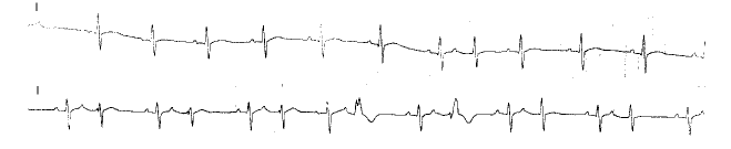 �������ķ�������������Ƶ�������Ƶķ���̽��(����������)