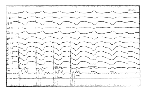 CARTO���ָ���ļ������������Ķ����ٵ���Ƶ����