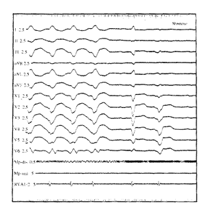 CARTO���ָ���ļ������������Ķ����ٵ���Ƶ����