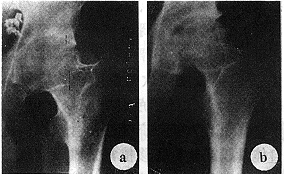 ��̥­�ǹ�Ĥ��ֲ�޸��Źؽ����Ǵ����ȱ���