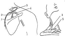 ����Ѫ�ܼ��θ�֧�ǰ���λ�޸�����ȱ���Ӧ�ý���