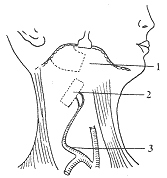 ����Ѫ�ܼ��θ�֧�ǰ���λ�޸�����ȱ���Ӧ�ý���