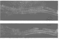 ��Ƥ���������ֲ�ڹ�ȱ������֯�ڳɹ����õ�ʵ���о����ٴ�Ӧ��