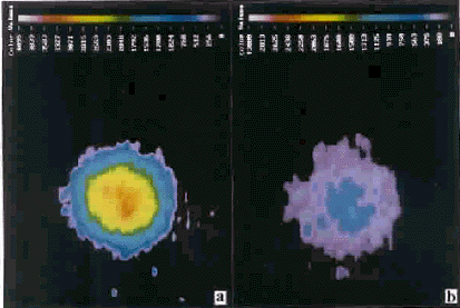 ���ü��⹲�۽�ͼ��ϵͳ���ʵ���Ա�̬��Ӧ���Լ����׶����ܰ�ϸ���������Ũ��