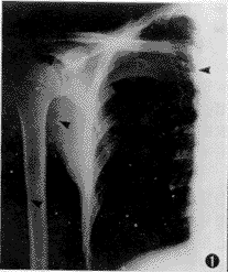 X�߸��������������ľ����ù��봫ͳ���ľ����ùܵĶԱ��о�