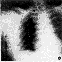 X�߸��������������ľ����ù��봫ͳ���ľ����ùܵĶԱ��о�